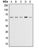 AKT1 + AKT2 + AKT3 Antibody - Western blot analysis of AKT (pY315) expression in HeLa (A); A549 (B); LOVO (C); HepG2 (D); NIH3T3 (E) whole cell lysates.
