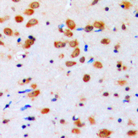 AKT1 + AKT2 + AKT3 Antibody - Immunohistochemical analysis of AKT (pY315) staining in human brain formalin fixed paraffin embedded tissue section. The section was pre-treated using heat mediated antigen retrieval with sodium citrate buffer (pH 6.0). The section was then incubated with the antibody at room temperature and detected using an HRP conjugated compact polymer system. DAB was used as the chromogen. The section was then counterstained with hematoxylin and mounted with DPX.