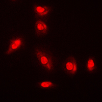 AKT1 + AKT2 + AKT3 Antibody - Immunofluorescent analysis of AKT (pY315) staining in A549 cells. Formalin-fixed cells were permeabilized with 0.1% Triton X-100 in TBS for 5-10 minutes and blocked with 3% BSA-PBS for 30 minutes at room temperature. Cells were probed with the primary antibody in 3% BSA-PBS and incubated overnight at 4 C in a humidified chamber. Cells were washed with PBST and incubated with a DyLight 594-conjugated secondary antibody (red) in PBS at room temperature in the dark. DAPI was used to stain the cell nuclei (blue).