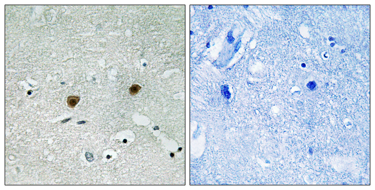 AKT1 + AKT2 + AKT3 Antibody - Immunohistochemistry analysis of paraffin-embedded human brain, using AKT1/2/3 (Phospho-Tyr315/316/312) Antibody. The picture on the right is blocked with the phospho peptide.