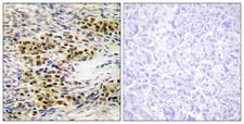 AKT1 + AKT2 Antibody - Immunohistochemistry analysis of paraffin-embedded human ovary tissue, using Akt Antibody. The picture on the right is blocked with the synthesized peptide.