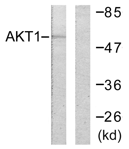 AKT1 + AKT2 Antibody - Western blot analysis of lysates from HeLa cells, treated with Etoposide 25uM 24h, using Akt Antibody. The lane on the right is blocked with the synthesized peptide.
