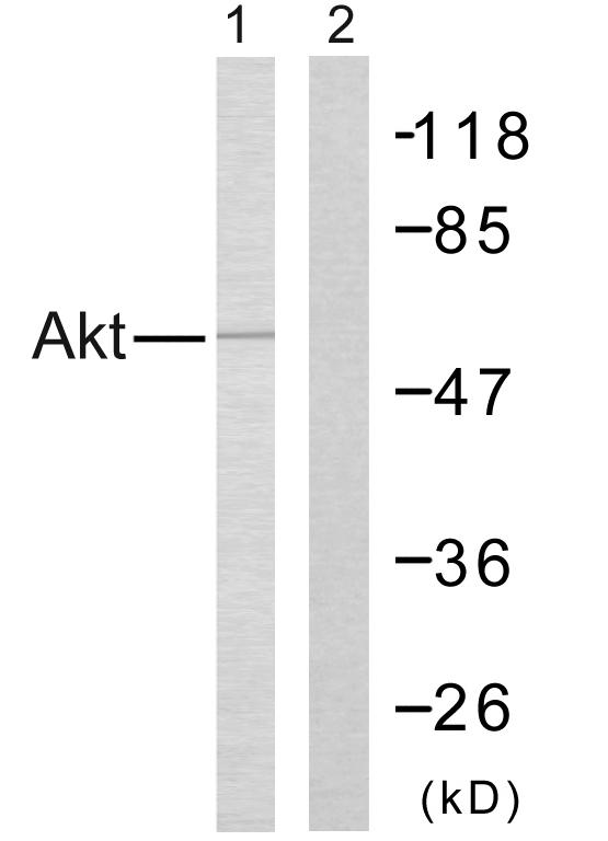AKT1 + AKT2 Antibody - Western blot analysis of lysates from Jurkat cells, treated with H2O2, using Akt Antibody. The lane on the right is blocked with the synthesized peptide.