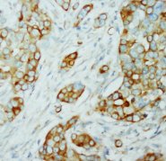 AKT1 + AKT2 Antibody -  This image was taken for the unconjugated form of this product. Other forms have not been tested.