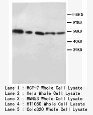 AKT1 + AKT2 Antibody -  This image was taken for the unconjugated form of this product. Other forms have not been tested.