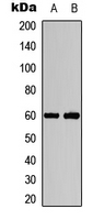 AKT1 + AKT2 Antibody - Western blot analysis of AKT1/2 (pT308/309) expression in HeLa (A); PC3 (B) whole cell lysates.