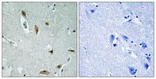 AKT1 + AKT3 Antibody - Immunohistochemistry analysis of paraffin-embedded human brain, using AKT1/3 (Phospho-Tyr437/434) Antibody. The picture on the right is blocked with the phospho peptide.