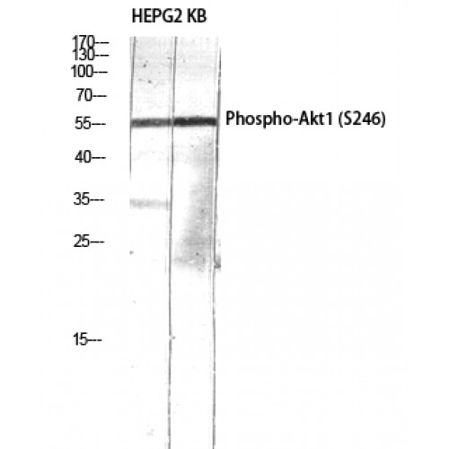 AKT1 Antibody - Western blot of Phospho-Akt1 (S246) antibody