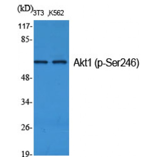 AKT1 Antibody - Western blot of Phospho-Akt1 (S246) antibody