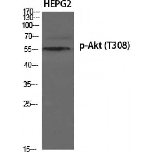 AKT1 Antibody - Western blot of Phospho-Akt (T308) antibody