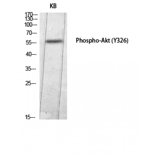 AKT1 Antibody - Western blot of Phospho-Akt (Y326) antibody