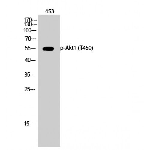 AKT1 Antibody - Western blot of Phospho-Akt1 (T450) antibody