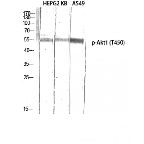 AKT1 Antibody - Western blot of Phospho-Akt1 (T450) antibody