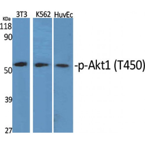 AKT1 Antibody - Western blot of Phospho-Akt1 (T450) antibody