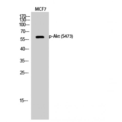 AKT1 Antibody - Western blot of Phospho-Akt (S473) antibody