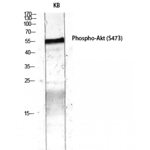 AKT1 Antibody - Western blot of Phospho-Akt (S473) antibody