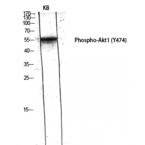 AKT1 Antibody - Western blot of Phospho-Akt1 (Y474) antibody
