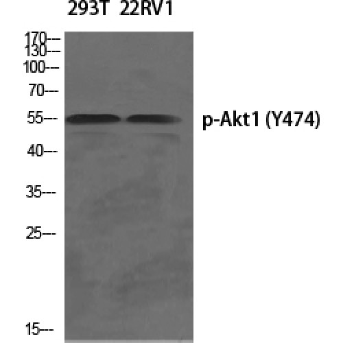 AKT1 Antibody - Western blot of Phospho-Akt1 (Y474) antibody