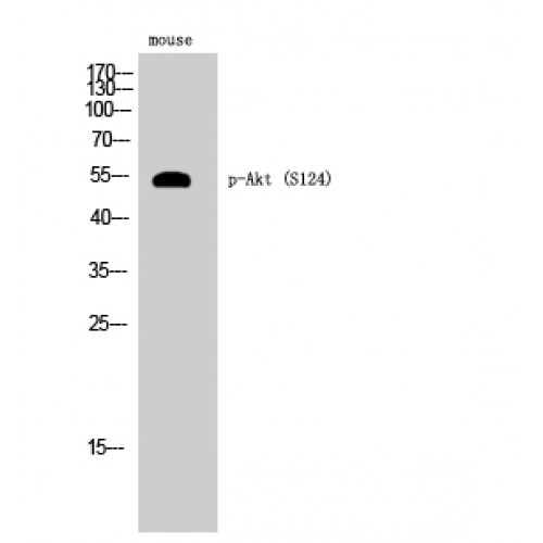 AKT1 Antibody - Western blot of Phospho-Akt (S124) antibody