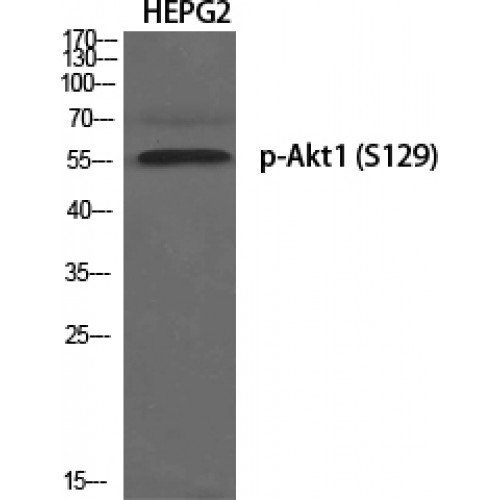 AKT1 Antibody - Western blot of Phospho-Akt1 (S129) antibody