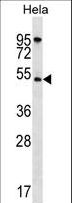 AKT1 Antibody - AKT1 Antibody western blot of HeLa cell line lysates (35 ug/lane). The AKT1 antibody detected the AKT1 protein (arrow).