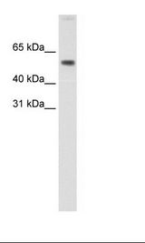 AKT1 Antibody - Fetal small Intestine Lysate.  This image was taken for the unconjugated form of this product. Other forms have not been tested.