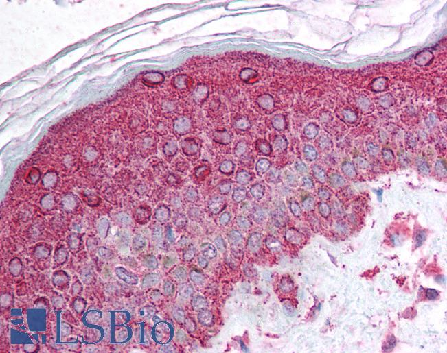 AKT1 Antibody - Anti-AKT1 antibody IHC of human skin. Immunohistochemistry of formalin-fixed, paraffin-embedded tissue after heat-induced antigen retrieval. Antibody concentration 5 ug/ml.  This image was taken for the unconjugated form of this product. Other forms have not been tested.