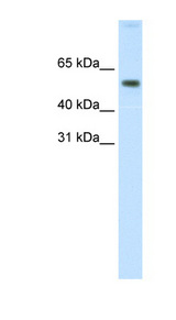 AKT1 Antibody - AKT1 antibody Western blot of Fetal small intestine lysate. This image was taken for the unconjugated form of this product. Other forms have not been tested.