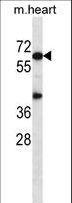 AKT1 Antibody - Mouse Akt1 Antibody western blot of mouse heart tissue lysates (35 ug/lane). The Akt1 antibody detected the Akt1 protein (arrow).