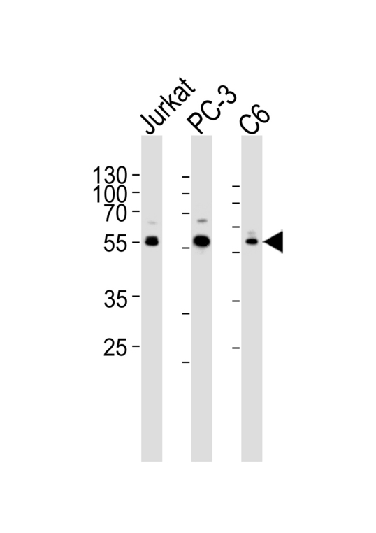 AKT1 Antibody - Western blot of lysates from Jurkat, PC-3, C6 cell line (from left to right) with AKT1/2/3 Antibody. Antibody was diluted at 1:1000 at each lane. A goat anti-rabbit IgG H&L (HRP) at 1:5000 dilution was used as the secondary antibody. Lysates at 35 ug per lane.