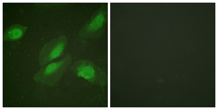 AKT1 Antibody - Immunofluorescence analysis of HeLa cells, using Akt Antibody. The picture on the right is blocked with the synthesized peptide.