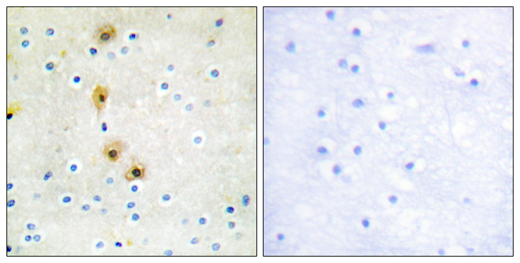 AKT1 Antibody - Immunohistochemistry analysis of paraffin-embedded human brain tissue, using Akt Antibody. The picture on the right is blocked with the synthesized peptide.