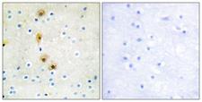AKT1 Antibody - Immunohistochemistry analysis of paraffin-embedded human brain tissue, using Akt Antibody. The picture on the right is blocked with the synthesized peptide.