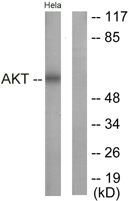 AKT1 Antibody - Western blot analysis of lysates from HeLa cells, treated with Insulin 0.01U/ml 15', using Akt Antibody. The lane on the right is blocked with the synthesized peptide.