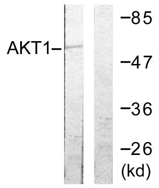 AKT1 Antibody - Western blot analysis of lysates from NIH/3T3 cells, treated with TNF-a 20ng/ml 30', using Akt Antibody. The lane on the right is blocked with the synthesized peptide.