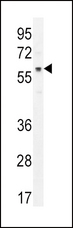 AKT1 Antibody - AKT1 Antibody (pT450) western blot of MCF-7 cell line lysates (35 ug/lane). The AKT1 antibody detected the AKT1 protein (arrow).