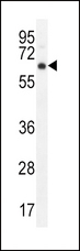 AKT1 Antibody - AKT1 Antibody (pT450) western blot of mouse cerebellum tissue lysates (35 ug/lane). The AKT1 antibody detected the AKT1 protein (arrow).