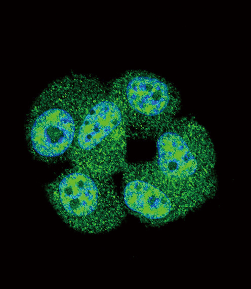 AKT1 Antibody - Confocal immunofluorescence of AKT1 Antibody (C-term T450) with MCF-7 cell followed by Alexa Fluor 488-conjugated goat anti-rabbit lgG (green). DAPI was used to stain the cell nuclear (blue).