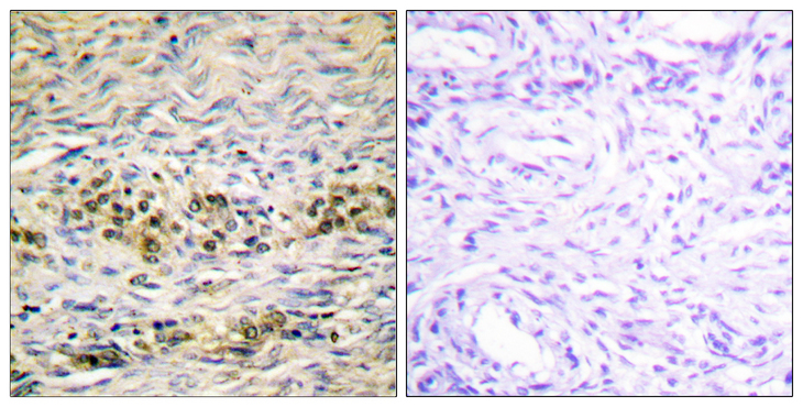 AKT1 Antibody - Immunohistochemistry analysis of paraffin-embedded human ovary tissue, using Akt Antibody. The picture on the right is blocked with the synthesized peptide.
