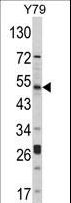 AKT1 Antibody - Western blot of hAKT1-D453 in Y79 cell line lysates (35 ug/lane). AKT1 (arrow) was detected using the purified antibody.