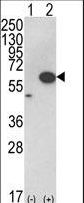 AKT1 Antibody - Western blot of AKT1 (arrow) using rabbit polyclonal hAKT1-D453. 293 cell lysates (2 ug/lane) either nontransfected (Lane 1) or transiently transfected with the AKT1 gene (Lane 2) (Origene Technologies).