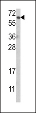 AKT1 Antibody - Western blot of AKT1 Antibody in MCF-7 cell line lysates (35 ug/lane). AKT1 (arrow) was detected using the purified antibody.