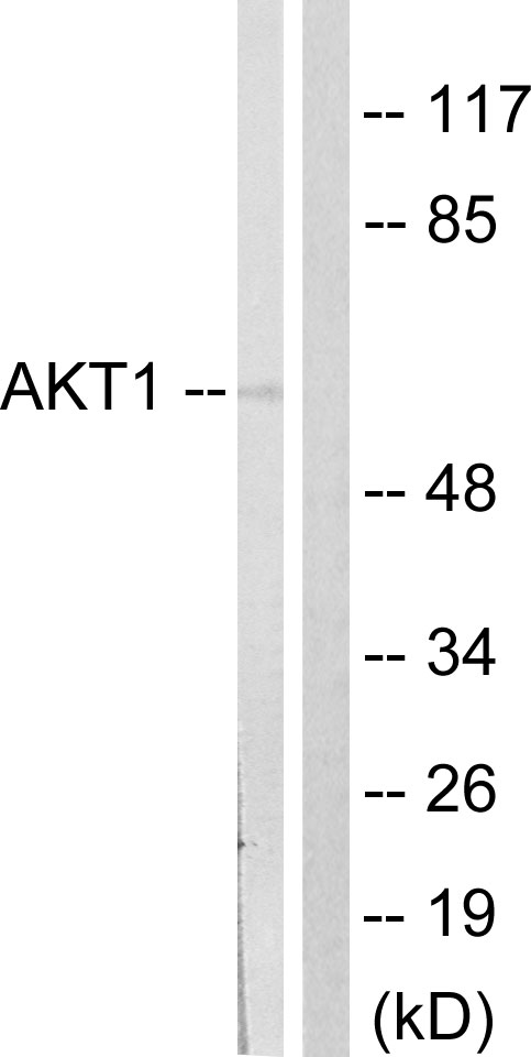 AKT1 Antibody - Western blot analysis of lysates from NIH/3T3 cells, treated with PDGF 50ng/ml 20', using Akt Antibody. The lane on the right is blocked with the synthesized peptide.