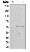 AKT1 Antibody - Western blot analysis of AKT expression in A549 (A); mouse brain (B); rat lung (C) whole cell lysates.