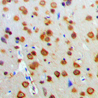 AKT1 Antibody - Immunohistochemical analysis of AKT staining in human brain formalin fixed paraffin embedded tissue section. The section was pre-treated using heat mediated antigen retrieval with sodium citrate buffer (pH 6.0). The section was then incubated with the antibody at room temperature and detected using an HRP conjugated compact polymer system. DAB was used as the chromogen. The section was then counterstained with hematoxylin and mounted with DPX.