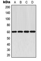 AKT1 Antibody - Western blot analysis of AKT expression in MCF7 (A); mouse lung (B); rat heart (C); rat brain (D) whole cell lysates.