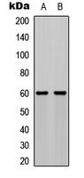 AKT1 Antibody - Western blot analysis of AKT (pS473) expression in MCF7 PDGF-treated (A); NIH3T3 PDGF-treated (B) whole cell lysates.
