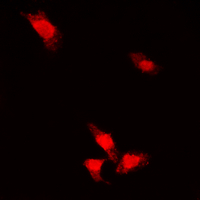 AKT1 Antibody - Immunofluorescent analysis of AKT (pS473) staining in MCF7 cells. Formalin-fixed cells were permeabilized with 0.1% Triton X-100 in TBS for 5-10 minutes and blocked with 3% BSA-PBS for 30 minutes at room temperature. Cells were probed with the primary antibody in 3% BSA-PBS and incubated overnight at 4 deg C in a humidified chamber. Cells were washed with PBST and incubated with a DyLight 594-conjugated secondary antibody (red) in PBS at room temperature in the dark. DAPI was used to stain the cell nuclei (blue).
