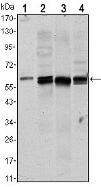 AKT1 Antibody - AKT1 Antibody in Western Blot (WB)