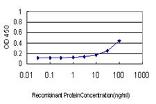AKT1 Antibody - Detection limit for recombinant GST tagged AKT1 is approximately 3 ng/ml as a capture antibody.